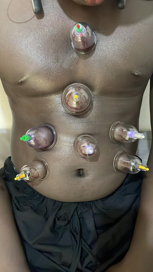 Abdominal Pain Hijama Therapy